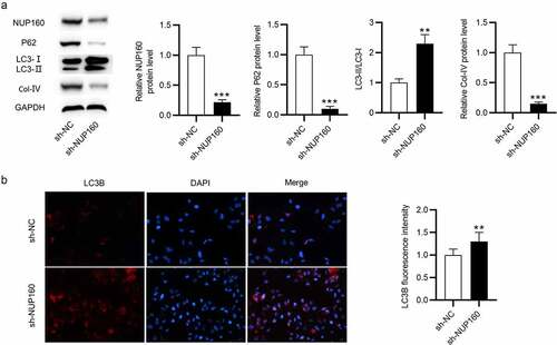 Figure 3. Effects of NUP160 depletion on autophagy in HG-treated NRK-52E cells. (a) The protein levels of NUP160, p62, LC3-I/II, and Col-IV in HG-treated NRK-52E cells transfected with sh-NUP160 were examined by western blot. (b) The expression of LC3B in HG-treated NRK-52E cells transfected with sh-NUP160 was examined using immunofluorescence assay. **P < 0.01, ***P < 0.001