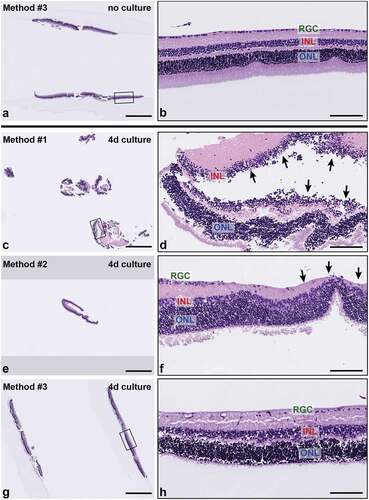 Figure 3. Representative H&E-stained sections of retinal explants from each sample handling and embedding approach. (a-b) Explant. no culture, embedded with Method #3. Non-cultured retinal explants embedded with Method #3 demonstrated all layers of the neural retina with normal morphology and cellularity. (c-h) Cultured explants showed variable degeneration of retinal ganglion cells and photoreceptor processes as well as cell-cell dyshesion. (c) Sample embedded using Method #1 shows severe fragmentation and tangential sectioning (d) and frequent separation of retinal layers (black arrows) (e-f). Sample embedded using Method #2 shows smaller sections of peripheral retina with less fragmentation, improved orientation and layer continuity. Black arrows in (f) indicate focal tangential sectioning. (g-h) Samples embedded using Method #3 show minimal fragmentation, proper orientation, and improved representation of full-thickness retinal cross sections. INL, inner nuclear layer, ONL; outer nuclear layer; and RGC, retinal ganglion cell layer. Scale bar = 1000 μm (a, c, e, g); 100 μm (b, d, f, h).