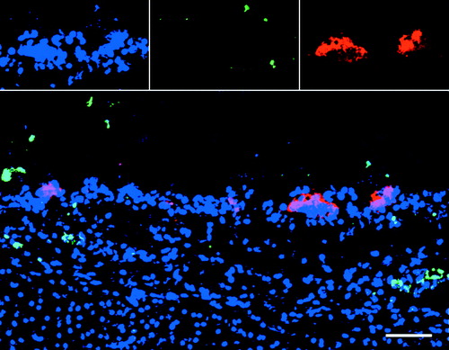 Figure 5. Representative confocal photomicrographs illustrating a small number of TUNEL-positive (apoptotic) cells in a region of ILTV-positive cells. Images for individual channels are shown on the top row from left to right (blue fluorescence, cell nuclei; green fluorescence TUNEL-positive cell; red fluorescence, viral antigen) with a larger, merged image below. TUNEL-positive cells were usually present in the vicinity of ILTV-infected cells. ILTV-infected cells were in general not apoptotic. Scale bar = 50 µm.