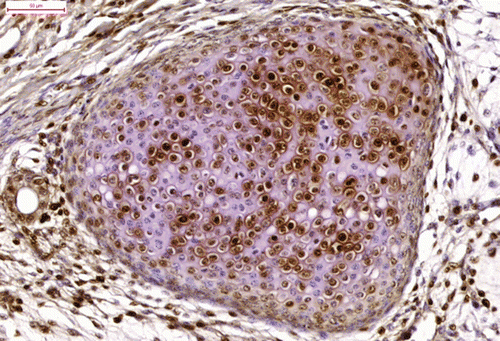 Figure 8.  The proliferating chondrocytes of the embryonic cartilage (proliferating cell nuclear antigen immunostaining). Bar = 50 μm.