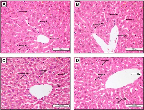 Figure 7 Photomicrographs of livers from: (A) the CN group; (B) the Z1 group (8 mg/kg); (C) the ZII group (16 mg/kg); and (D) the ZIII group (20 mg/kg).