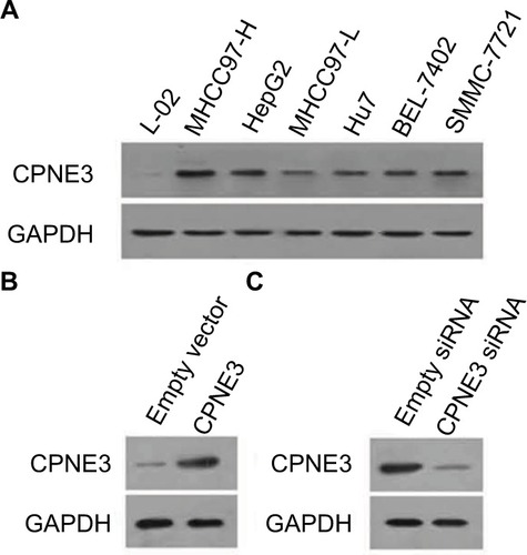 Figure 2 Expression of copine-III in hepatic cell lines.Notes: (A) Endogenous protein level of copine-III was detected in L-02, MHCC97-H, MHCC97-L, Hu7, BEL-7402, SMMC-7721, and HepG2 cell lines by Western blotting. CPNE3 expression vectors boosted the expression of copine-III in L-02 cells (C), and infection of siCPNE3 significantly reduced the expression of copine-III in MHCC97-H cells (B).