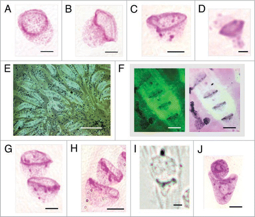 Figure 5 Bell shaped metakaryotic nuclei in development of animals and a plant. (A) Human gut, 7 weeks. (B) Rat, rib cage muscle, 18 days. (C) Mouse spinal cord ganglia, 16.5 days. (D) Plant Arabidopsis, embryonic stem, 1.5 days post germination. (A–D) Feulgen purple stained nuclear DNA. Note condensed, ring-like DNA at bell's mouth in all species. (E) Cluster of tubular syncytia in mouse fetal spinal cord ganglia at 14.5 days, green Feulgen fluorescence. (F) Syncytial bell shaped nuclei of mouse fetal spinal cord ganglia, 16.5 days. Green Feulgen fluorescence (left) superimposed on purple stained Feulgen image (right). (G) Symmetrical, ‘bell-to-bell’ nuclear fission in mouse spinal cord ganglia, 14.5 days. (H) Symmetrical, ‘bell-to-bell’ nuclear fission in rat rib cage muscle, 18 days. (I) Asymmetrical, ‘bell-to-sphere’ nuclear fission delineated in syncytium of a mouse spinal cord ganglia, 14.5 days, phase contrast. (J) Asymmetrical, ‘bell-to-condensed sphere’ nuclear fission in mouse myocyte cell line (Dr. J. Sherley, Boston Biomedical Research Institute, Watertown, MA). Scale bar, 5 µm, save in (D), 2 µm and in (E), 100 µm.