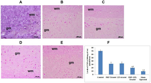 Figure 5 Effect of PHP and ZFL on tissue levels and immunohistochemical localization of TNF-α.