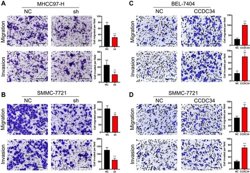 Figure 3 HCC cell migration and invasion in vitro regulated by CCDC34.Notes: (A and B) The migration and invasion ability of the MHCC97-H (A) and SMMC-7721 (B) cells transfected with the shCCDC34 or NC lentivirus were measured by the transwell assays. (C and D). The migration and invasion ability of the BEL-7404 (C) and SMMC-7721 (D) cells transfected with the CCDC34-OE or NC lentivirus were measured by the transwell assays. Scale bar = 100 μm. **P<0.01; ***P<0.001.Abbreviations: HCC, hepatocellular carcinoma; NC, negative control; OE, overexpression.