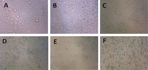 Figure 3.  Morphological changes of crocin and liposomal crocin in MCF-7 and HeLa cells. HeLa and MCF-7 control cells (A and B), 48 h after treatment with 1 mM of crocin (C and D) and liposomal crocin (E and F). Control cells (A and B) remained untreated although receiving an equal volume of the solvent.