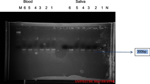 Plate 1 Gel electrophoresis result of the nested PCR product carried out on blood and saliva showing the Pfcrt genetic marker.Abbreviations: M, molecular marker; bp, base pair.
