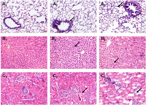Figure 2 Effects of Nano-TiO2 exposure on the histopathological changes in the lung, liver, and kidney at 7 days after treatment. (A) The representative images of lung tissue of rats stained with HE. (B) The representative images of liver tissue of rats stained with HE. (C) The representative images of kidney tissue of rats stained with HE. Scale bar represents 50 μm. The arrow in A2 indicated irregular luminal inflammatory cell infiltration; The arrow in A3indicated the alveolar wall thickening. The arrow in B2 indicated cell disorder. The arrow in B3 indicated the spotty necrosis. The arrow in C2 indicated the gap increases. The arrow in C3 indicated necrosis. 1: Control group, 2: 0.2 g/kg group, 3: 1 g/kg group.