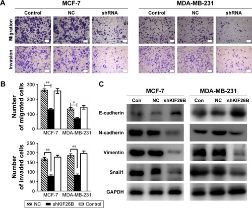 Figure 5 Knockdown of KIF26B inhibits tumor metastasis and invasion by modulating EMT-related genes.