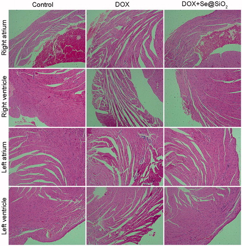 Figure 7. Histology of heart tissues exposed to control, DOX and DOX + Se@SiO2 treatment. Haematoxylin and eosin (H&E) staining (400×magnification) of various tissue slices from mice with indicated treatments.
