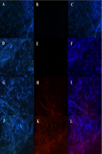 Figure 11 Fluorescence in the brain (A–C) No treatment, (D–F) free RhB-HupA, (G–I) RhB-HupA-NE and (J–L) Lf-RhB-HupA-NE. Red: RhB- HupA, Blue: cell nucleus.