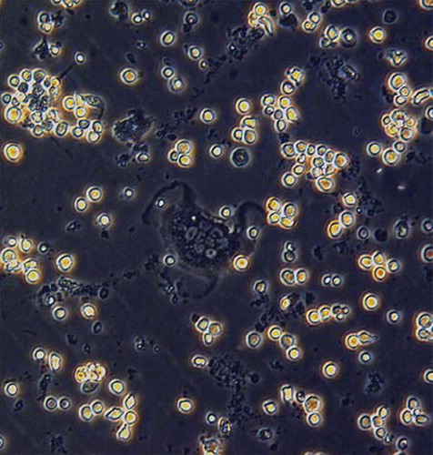 Figure 1. (×300): Four hours after inoculation, most of the osteoclasts obtained by mechanical separation were adhered to the wall. The cells were generally small and round, and partially spread. Some cells were large in area, polynuclear, and in irregular shapes.