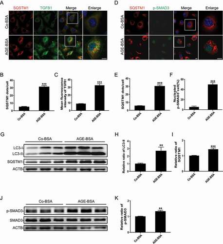 Figure 1. AGE-BSA-induced SMAD3 activation is associated with autophagic blockage in HK-2 cells. (A) Double immunofluorescence staining of SQSTM1 and TGFB1 in HK-2 cells exposed to 30 μg/ml AGE-BSA or 30 μg/ml Co-BSA for 24 h. (B and C) Quantification of SQSTM1 puncta and TGFB1 fluorescence intensity. (D) Double immunofluorescence staining of SQSTM1 and phospho-SMAD3 in AGE-BSA or Co-BSA-treated HK-2 cells. (E and F) Quantification of SQSTM1 puncta and phospho-SMAD3 protein-positive nuclei. (G–K) Western blot analysis of LC3, SQSTM1, and phospho-SMAD3 expression in AGE-BSA or Co-BSA-treated HK-2 cells. Bars represent means ± SEM from at least 3 independent experiments. *P< 0.05, **P< 0.01 and ***P< 0.001. DAPI was used to stain nuclei. Scale bar: 10 µm