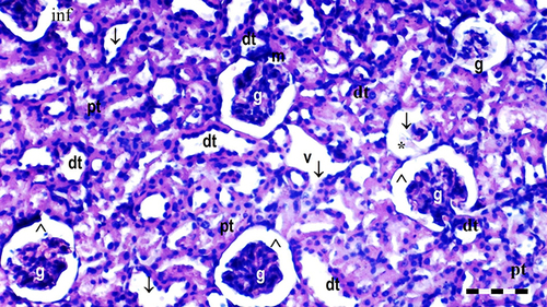 Figure 8 Representative light microscopy of kidney tissue from the diabetes group. Scale bar 50 µm, H&Ex100.