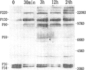 Figure 1 Immunoblotting analysis of tyrosine protein phosphorylation in 0.1 mg/ml matrine-treated K562 cells at various times. Treatment of K562 with matrine resulted in an increase in tyrosine phosphorylation of proteins migrating at 220 (P220), 130 (P130), 90 (P90), and 69 (P69) kDa starting at 30 min after matrine addition and lasting for the entire experiment period. Phosphorylation of two proteins with 36 kDa and 34 kDa were downregulated, whereas both elevated to control levels by 24 h. Positions of molecular mass markers are shown to the right (in kilodaltons). Each experiment was repeated two times and similar results were obtained.