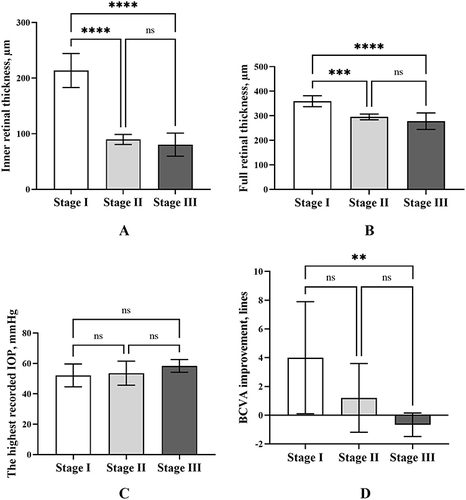 Figure 3 Bar charts showing the PAMM group patients’ characteristics. Error bars are standard deviations. (A) Inner retinal thickness among the three stages. (B) Full retinal thickness among the three stages. (C) The highest recorded IOP among the three stages. (D) BCVA improvement from baseline at final visit, lines. ** P < 0.01, *** P < 0.001, **** P < 0.0001. Stage I: edema, Stage II: edema resolution, Stage III: atrophy.