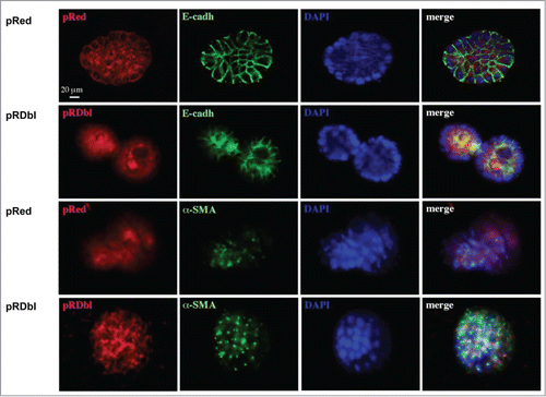 Figure 6. Dbl oncogene induces loss of proliferative suppression and luminal apoptosis. Acini cultured for 10 days in Matrigel were fixed and immunostained with antibodies against Red epitope (red), E-cadherin (green) and α-SMA (green). Nuclei were counterstained with DAPI (blue). Scale bar: 20 μm.