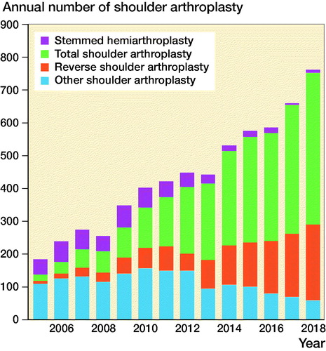 Figure 2. Change in the use of different arthroplasty design over time, Norwegian Arthroplasty Register 2005–2018.