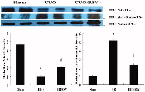 Figure 6. Effect of RSV on acetylation of Smad3 and Sirt1 levels in UUO model. Immunoprecipitation/Western blot showed increased acetylation levels of Smad3 and decreased Sirt1 activity in UUO model. However, RSV treatment significantly reversed these protein levels. All values are expressed as mean ± SEM, *p < 0.01 versus the sham group; #p < 0.01, UUO versus the UUO/RSV group. Ac-Smad3: acetylation of Smad3; IB: immunoblotting.