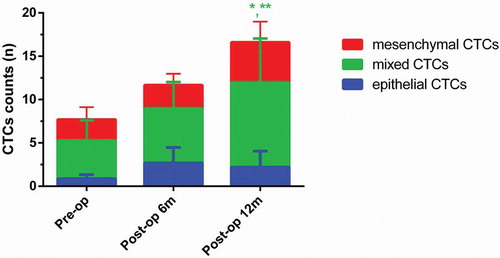 Figure 3. Dynamic changes of three CTCs types in the metastatic group. (Data were presented as mean ± SD and P < 0.05 was considered statistically significant. Pre-op: preoperatively, post-op 6m: 6 months postoperatively, post-op 12m: 12 months postoperatively. * P < 0.05 Post-op 12m vs. Pre-op; ** P < 0.05 Post-op 12m vs. Post-op 6m.).