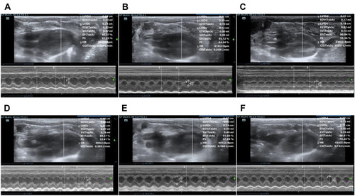 Figure 4 Heart M-mode ultrasound images. (A) Sham group at 12h. (B) CLP group at 12h. (C) CLP+Cur at 12h. (D) Sham group at 24h. (E) CLP group at 24h. (F) CLP+Cur at 24h. The stroke volume and heart rate were measured by M-mode ultrasound, and then the cardiac output was calculated.