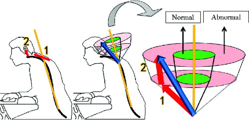 Figure 5. Vector model on human body.