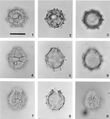 Plate 3. Light photomicrographs of Cladopyxidium sp. A, taken under Nomarski interference contrast. All specimens are Maastrichtian in age, and are from the Netherlands. Scale bar (see figure 1) = 10 µm for all figures. 1–3. Focus series through specimen in apical view (sulcus towards top). Figure 1, apical focus showing subcircular archeopyle (operculum missing) and anterior intercalary plates; figure 2, optical section; figure 3, antapical focus. Note relative sizes of 1″″ and 1p; suture separating them runs from base of ps to base of 3′′′. Curfs Quarry. 4–6. Focus series through specimen in dorsal view. Figure 4, dorsal focus; figure 5, optical section; figure 6, ventral focus. Curfs Quarry. 7, 8. Ventral focus (figure 7) and optical section (figure 8) of specimen in ventral view. Figure 7, note 1′ and 4′; figure 8, note pores penetrating entire thickness of autophragm. Albert Canal. 9. Specimen in ventral view, ventral focus, showing midventral tabulation. ENCI Quarry.