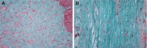 Figure 3 Comparison of control group (A) versus treatment group (B): collagen in scar tissue (Masson trichrome staining, 400×).
