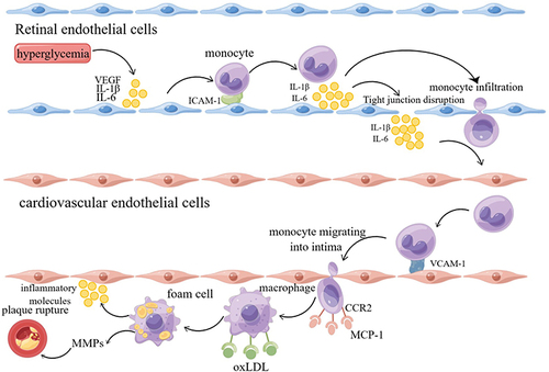 Figure 3 Hypothesis of inflammation as a key factor in the development of atherosclerotic cardiovascular disease induced by diabetic retinopathy (By Figdraw). Hyperglycemia causes retinal endothelial cell dysfunction and produces inflammatory factors such as VEGF and IL-6. Inflammatory factors destroy the tight junction between endothelial cells, destroy BRB, promote the extravasation of inflammatory cells such as monocytes, and further aggravate the inflammatory state of tissues. Driven by inflammation, endothelial cells synthesize uncontrolled inflammatory mediators, resulting in a surge of inflammatory mediators entering the systemic circulation. When vascular endothelial cells are activated by inflammation, it leads to the development of atherosclerosis and eventually leads to the occurrence of CVD.