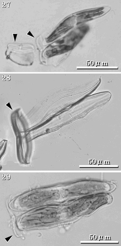 Figs 27–29. LMs of auxospores and initial cells. Arrowheads indicate mother frustules. Fig. 27. Auxospores attached to one of the mother frustules. Fig. 28. Perizonia of pre-initial cells that have not formed RVs, ARVs or girdles. Fig. 29. Initial cells. Note that these become about three times the size of the mother cell.