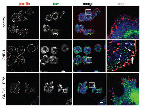 Figure 1 The accumulation of Cav1 at peripheral FAs following Rac1 activation requires Src activity. Hela cells were grown on glass coverl slips and stimulated as indicated with CNF1 (500 ng/ml, 4 h) (Co) localization of endogenous Cav1 with endogenous paxillin was analyzed by immunostainings in control, CNF-1-treated or CNF-1-treated Hela cells that were also treated with PP2 (10 µM) for 30 min prior to fixation. Cav1-paxillin co-localization resulting from the activation of endogenous Rac1 by CNF1 is indicated by the arrows. (Scale bar, 20 µm).