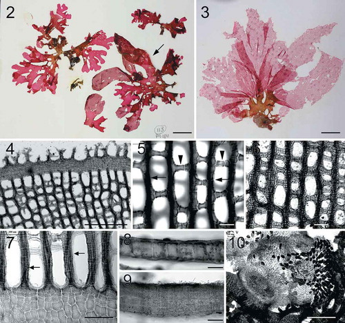 Figs 2–10. Habit and morphology of Martensia abbottiae sp. nov. Fig. 2. Holotype specimen BISH 776243 (arrow) (from collection ARS 09458). Fig. 3. Voucher specimen BISH 776245 (ARS 09464), a female gametophyte. Fig. 4. Dentations and finger-like projections along leading margin of networks (BISH 776246; ARS 09470). Fig. 5. One cell-layered primary longitudinal (arrows) and cross-connecting lamellae (arrowheads) of network (BISH 776243; from collection ARS 09458). Fig. 6. Older network (BISH 776246; ARS 09470). Fig. 7. Basal part of developing network showing elongated longitudinal lamellae (arrows) (BISH 776246; ARS 09470). Fig. 8. Cross section through upper part of membranous blade (BISH 776246; ARS 09470). Fig. 9. Cross section through basal part of membranous blade (BISH 776243; from collection ARS 09458). Fig. 10. Squashed mature cystocarp showing extruded carpospores (BISH 776245; ARS 09464). Scale bars = 2 cm (Fig. 2), 3 cm (Fig. 3), 500 µm (Figs 4, 10), 100 µm (Figs 6–7), 50 µm (Figs 5, 8–9).