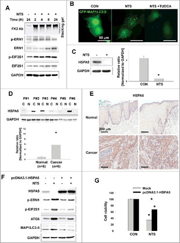 Figure 2. NTS-induced inhibition of HSPA5 expression and its pivotal role in ER stress or autophagy. (A) FaDu cells were treated with NTS for the indicated times and protein levels were evaluated by western blot assay. (B) Inhibition of NTS-induced ER stress prevents autophagy. GFP-MAP1LC3-II plasmids were transfected into FaDu cells and 24 h later, the cells were pretreated with TUDCA (1 mg/ml) for 1 h. NTS treatment was given for 24 h with or without TUDCA in absence of serum. GFP-MAP1LC3-II puncta were analyzed with a fluorescence microscope (scale bar: 50 μm). (C) HSPA5 was decreased in response to NTS. FaDu cells were treated with NTS for 24 h in the absence of serum, and HSPA5 expression was determined by western blot assay (n = 3). (D) HSPA5 overexpression in HNC tissues. Proteins were isolated from frozen tissues of 6 patients with HNC, and HSPA5 expression level was determined by western blot assay (n = 6; C, cancer tissue; N, normal tissue; P, patient). (E) The immunohistochemistry analysis of HSPA5 in cancer or normal (scale bar: 200 μm). (F and G) HSPA5 overexpression inhibited NTS-induced ER stress, autophagy and cytotoxicity. HSPA5 plasmids were transfected into FaDu cells, and the cells were treated with NTS for 24 h in the absence of serum. Protein levels were evaluated by western blot assay (F) and MTT assay (G; n = 6). (C, D and G) Data are means ± SD. Asterisks indicate statistically significant differences (P < 0.05).