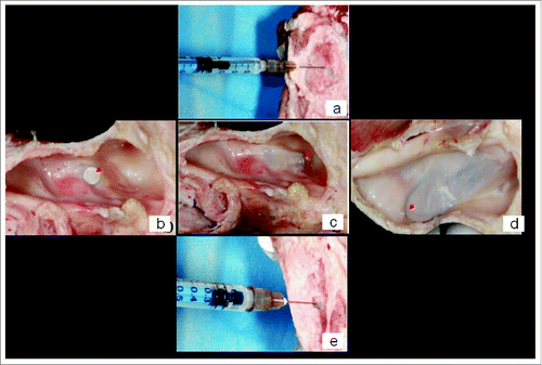 Figure 4. The determination of space volume created under the elevated maxillary sinus mucosa: (A) adding saline into the space before detaching maxillary sinus mucosa through the implant socket; (B) detaching maxillary sinus mucosa ex vivo using umbrella-shaped sinus lift curette YSL-04 with the tip of YSL-04 being seen under the sinus mucosa (red arrow); (C) detaching maxillary sinus mucosa ex vivo using probe-improved sinus lift curette with the tip being seen under the sinus mucosa (red arrow); (D) detaching maxillary sinus mucosa ex vivo using elevator 014 with the shape-memory Ni/Ti alloy wire being seen under the sinus mucosa (red arrow); (E) adding saline into the space after detaching maxillary sinus mucosa through the implant socket.