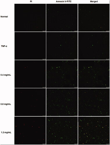 Figure 4. ACR induces apoptosis in MH7A cells. MH7A cells were treated with ACR (0.4, 0.8, 1.2 mg/mL) for 24 h, followed by assessment of apoptosis under laser scanning confocal microscope. ACR: an aqueous extract of Cinnamomi ramulus.