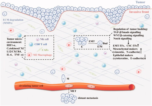 Figure 2. The mechanism of tumour budding: 1. Regulate the phenotype of tumour cells through TGF- β/SMADS, Notch, WNT/β-catenin and other signal pathways, thereby inducing the EMT process, such as epithelial marker CK downregulation, mesenchymal marker vimentin upregulation, EMT-related transcription factors (ZEB, Twist, Snail) and cancer stem cell markers were up-regulated, and cell adhesion loss (E-cadherin down-regulated); 2.Hypoxia and various cytokines in the tumour microenvironment affect tumour budding.
