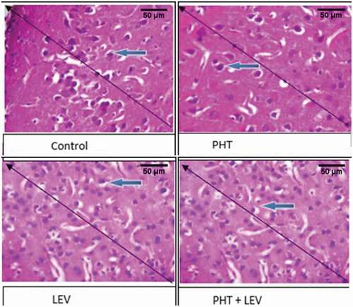 Figure 7. The histomorphology of hippocampus following PHT, LEV and PHT+ LEV adjunctive treatment in male Wistar rats