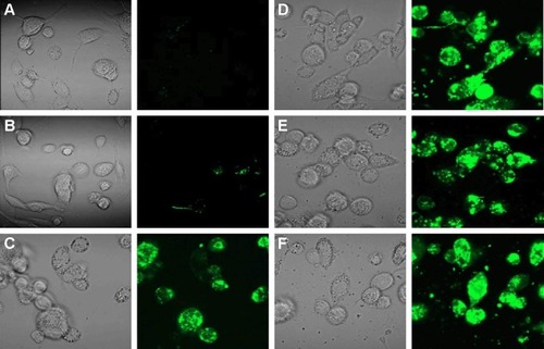 Figure 4 Confocal microscopy analysis of internalization of fluorescent BSA in live monocyte-derived macrophage cells.Notes: (A) Untreated control THP-1 MDM cells. THP-1 MDM cells were treated for 3 hours with (B) 1 µg/mL of FITC-BSA alone (equivalent amount of BSA found in 64 µg/mL of PLGA-FITC-BSA NPs), (C) 20 µg/mL, (D) 100 µg/mL, (E) 500 µg/mL, and (F) 1,000 µg/mL of PLGA-FITC-BSA NPs. Images are representative of three separate experiments. Magnification 630×. Green fluorescence: FITC-BSA.Abbreviations: BSA, bovine serum albumin; MDM, monocyte-derived macrophages; PLGA, poly(lactic-co-glycolic) acid; NPs, nanoparticles; FITC, fluorescein isothiocyanate.