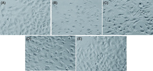 Figure 5. Alterations in the morphology of HepG2. Cells were pre-exposed with LSE for 24 h, then hydrogen peroxide (H2O2) for 24 h. Image were taken using phase contrast-inverted microscope at 20× magnification. (A) Control, (B) H2O2 (0.25 mM), (C) LSE (5 μg/ml) + H2O2 (0.25 mM), (D) LSE (10 μg/ml) + H2O2 (0.25 mM), and (E) LSE (25 μg/ml) + H2O2 (0.25 mM).