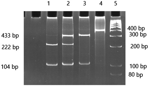 Figure 2. A total of 12% polyacrylamide gel pattern of GSTP1 polymorphism digested PCR products with ALW26I enzyme. From left to right lane 1 indicate lanes 1 homozygous Val/Val, lane 2 heterozygote Ile/Val, lane 3 wild type Ile/Ile, lane 4 PCR product, and lane 5 molecular marker.