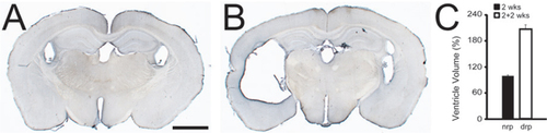 Figure 3. Direct pump reconnection can cause increased ventricle volume.(A) PBS application (2 weeks) into the ventricle of 3 month old TK mice does not alter the size of the lateral ventricle system (n = 3). (B) Pump reservoir replacement applying direct reconnection of the tubing to the brain cannula (after initial 2 weeks PBS application) results in hydrocephalus in 3 month old TK mice 2 weeks after pump reservoir exchange (n = 3). Calibration bar: 1000 µm. (C) Quantitative stereological analysis of the ratio of lateral ventricle volume to total brain volume reveals a 2-fold increase (mean ± SEM; n = 3 mice/group); t-test indicates a significant difference between the groups (not replaced pump (nrp) and directly replaced pump (drp); t = 13.28, df = 4, ***P < 0.001).