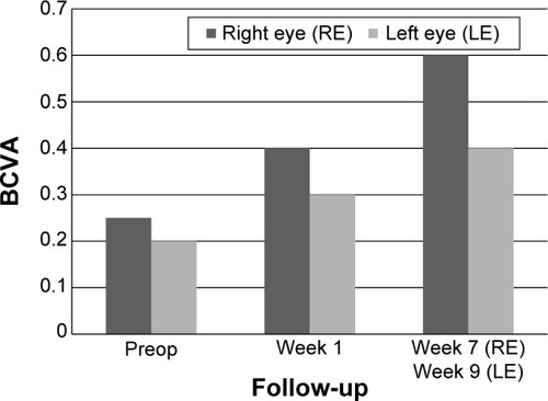 Figure 6 Data from patient number 2 showing BCVA at preop and postop visits.