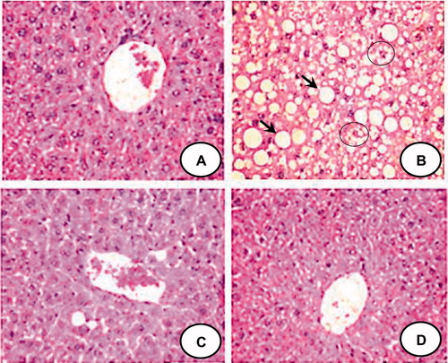Figure 2. Representative liver sections stained with hematoxylin and eosin (40×) from each group. CON group (A) shows normal architecture of liver. HFFD group (B) shows large cytoplasmic lipid droplets (indicated by arrows) and ballooning degeneration (indicated by circle). HFFD + GEN group (C) shows less lipid vacuoles as compared to HFFD suggesting a reduction in lipid deposition. CON + GEN group (D) shows normal architecture of liver.