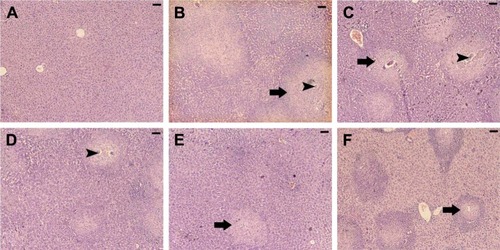 Figure 3 Histological changes in hepatic tissue of noninfected mice, untreated mice, and mice treated and infected with Schistosoma mansoni on day 56 postinfection.Notes: (A) Noninfected liver with normal architecture. (B) Hepatic tissue of mice in the S. mansoni-infected group showing a severe inflammatory response in the liver indicated by inflammatory cellular infiltration, cytoplasmic vacuolation, degeneration of hepatocytes, dilated hepatic sinusoids dilated, and more Kupffer cells. (C–E) Hepatic tissue of mice in the S. mansoni-infected group treated with 0.25, 0.5, and 1 mg/kg AuNPs, respectively, showing reduced tissue damage, and (F) the liver of mice in the infected group treated with PZQ showing fewer lesions. Arrows indicate the inflammatory cellular infiltraion around the granuloma and arrow heads indicates enclosed eggs. Sections were stained with hematoxylin and eosin; scale bar =25 μm.Abbreviations: AuNPs, gold nanoparticles; PZQ, praziquantel.