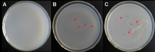 Figure 2 Detection of M12 resistance to SWU1. (A) As a blank control. (B) M12, and (C) M. smegmatis mc2 155 does not affect the replication of SWU1. Red arrows indicate plaques of phages.