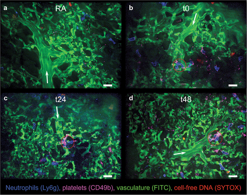 Figure 2. Intravital confocal lung imaging reveals increased neutrophil presence, occlusive neutrophil-platelet aggregates, and thrombi in the pulmonary microvasculature of EC-exposed mice. Representative fluorescent fields of view (FOVs) from A) mice exposed to room air (RA); B) EC-exposed mice immediately after exposure (t0); C) approximately 24 hr following exposure (t24); or D) approximately 48 hr following exposure (t48) are shown. At least 15 FOVs containing venule/arteriole-capillary interfaces were randomly collected from n = 5 mice per group. Neutrophils shown in blue, platelets in pink, vasculature in green, and cell-free DNA in red. Arrows indicate blood flow direction. Red circles show neutrophil-platelet aggregates which included two or more neutrophils. Areas of SYTOX staining outside the focal plane, or SYTOX+ objects outside of the bounds of the vasculature were considered as general cell-free DNA rather than true intravascular NETs. Scale bars 20 µm. See supplementary videos 1–4 for short intravital clips of each FOV shown here.