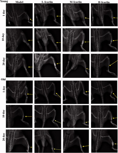 Figure 1. Icariin accelerated fracture healing in the rat model of fractures. Digital radiography (DR) was used to observe fracture healing on the 1st day, 10th day and 20th day.