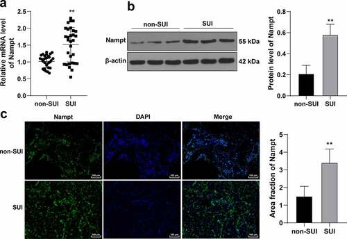 Figure 1. Nampt is overexpressed in SUI patients. Anterior vaginal wall tissues were extracted from SUI and non-SUI patients. (a), mRNA level of Nampt in tissues was examined by RT-qPCR. (b), Protein level of Nampt in tissues was tested by Western blot analysis. (c), Nampt fluorescence signal in tissues was assessed by immunofluorescence assay. N = 30. Measurement data in panels (b and c) were presented as mean ± standard deviation. The t-test was used to analyze the data in panels (a, b and c). ** p < 0.01.