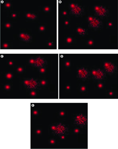Figure 3. Single-cell gel electrophoresis (SCGS; COMET) assay showing the degree of DNA damage in the brain tissue.Of (A) control group revealing no significant DNA damage. (B) The SN hypoxic group revealing a highly significant DNA damage represented by tail length. (C) The sophoretin-treated group revealing low DNA damage. (D) The melatonin treated group with moderate DNA damage. (E) The sophoretin and melatonin-treated group with the lowest DNA damage.