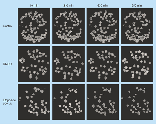 Figure 3.  Hologram images of U2932 cells captured on antibody HLA-DR.The images are showing control, DMSO and etoposide-treated cells at four different timepoints: 10, 310, 630 and 950 min. The cells are segmented to analyze cell parameters.DMSO: Dimethyl sulfoxide